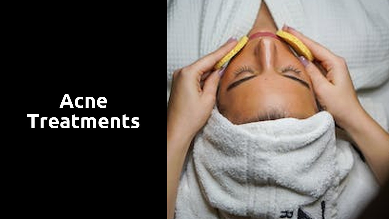 Acne Treatments